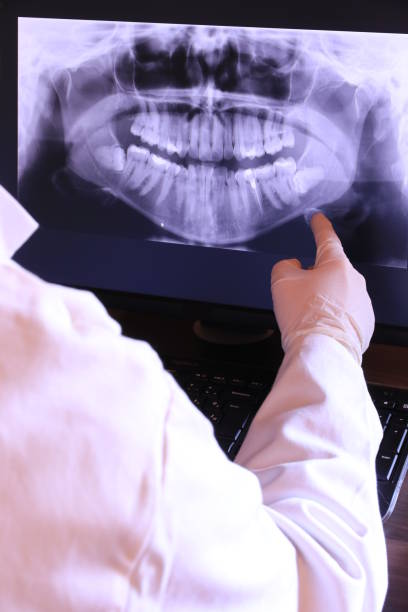 Best Emergency Root Canal Therapy in Forsyth, MT