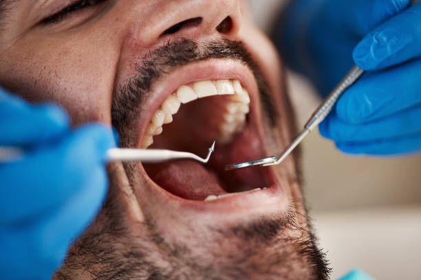 Best Emergency Denture Repair in Forsyth, MT