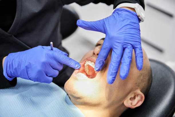 Best Emergency Care for Gum Disease in Forsyth, MT